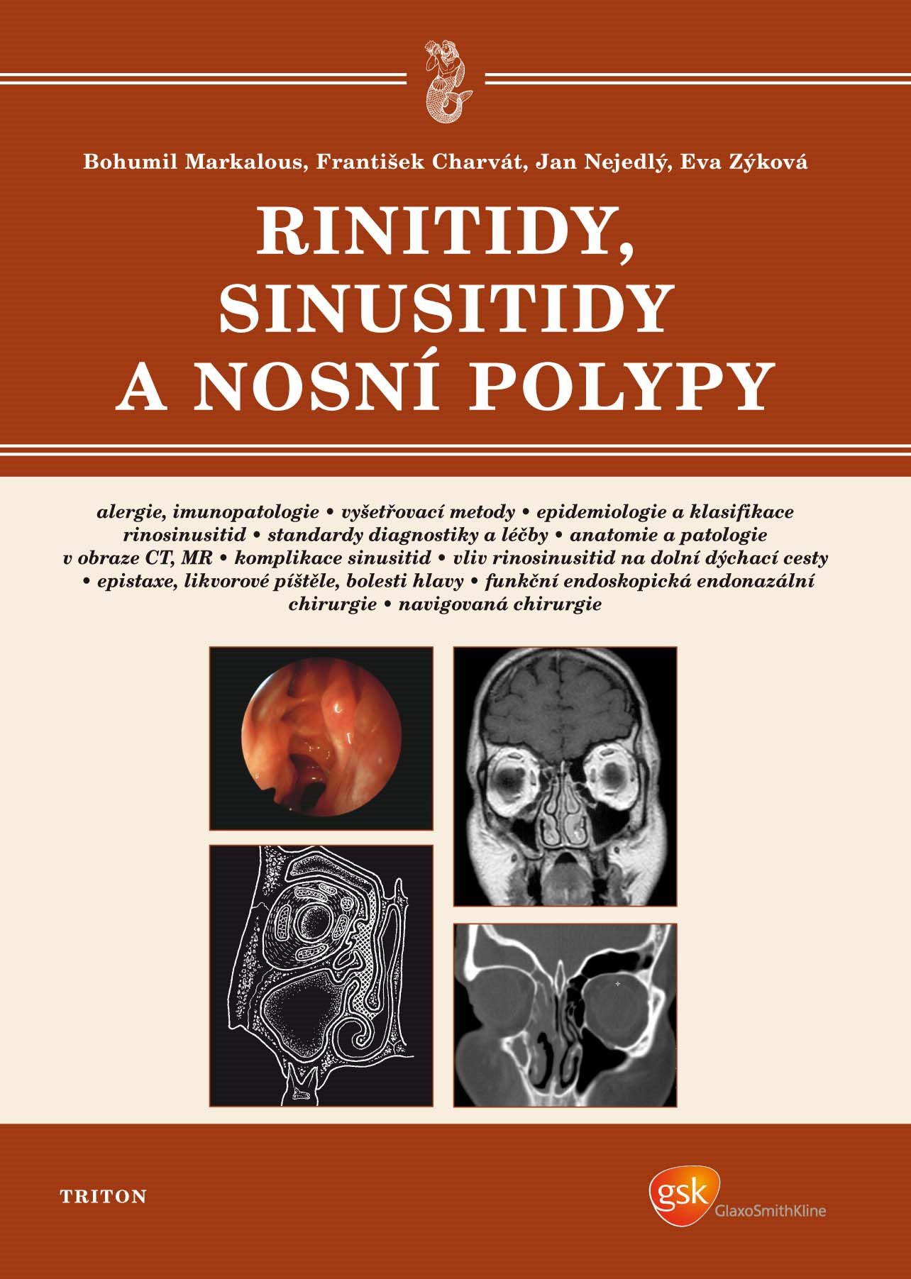 Rinitidy, sinusitidy a nosní polypy [E-kniha] - MUDr. Bohumil...