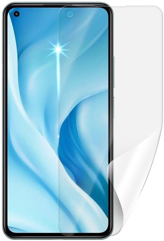 Screenshield Anti-Bacteria für XIAOMI 11 Lite 5G NE -...