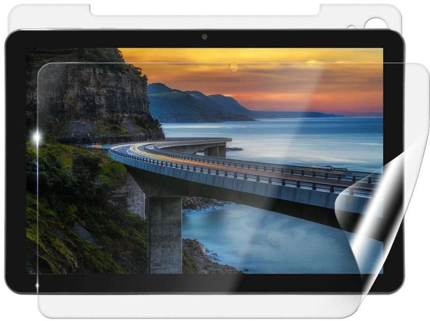 Screenshield IGET Smart W30 fólie na celé tělo Védőfólia