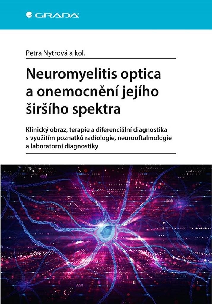 Neuromyelitis optica a poruchy jejího šišího spektra: Klinický obraz, terapie a dif. diagnostika s v