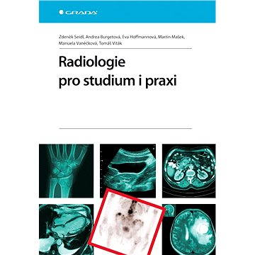 Radiologie pro studium i praxi (978-80-247-4108-6)