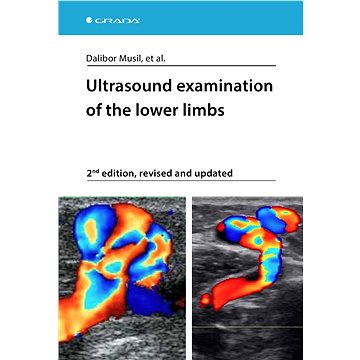 Ultrasound examination of the lower limbs (978-80-271-0657-8)