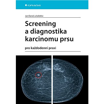Screening a diagnostika karcinomu prsu (978-80-271-1239-5)