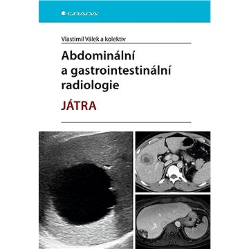 Abdominální a gastrointestinální radiologie (978-80-271-3279-9)