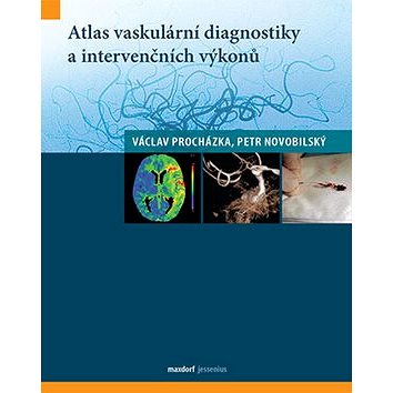 Atlas vaskulární diagnostiky a intervenčních výkonů (978-80-7345-472-2)
