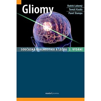 Gliomy (978-80-7345-561-3)