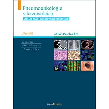 Pneumoonkologie v kazuistikách: Úspěchy a kontroverze v hrudní onkologii (978-80-7345-588-0)