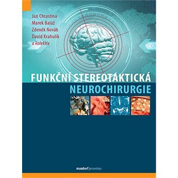Funkční stereotaktická neurochirurgie (978-80-7345-590-3)