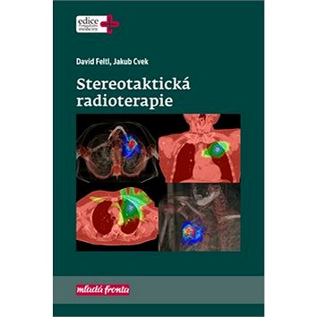 Stereotaktická radioterapie (978-80-204-4959-7)