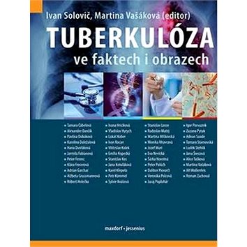 Tuberkulóza ve faktech i obrazech (978-80-7345-613-9)