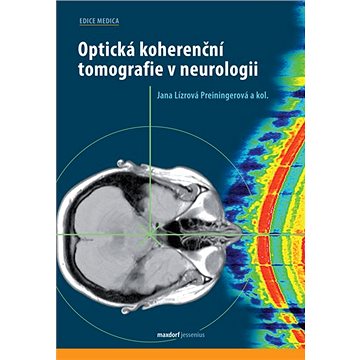 Optická koherenční tomografie v neurologii (978-80-7345-661-0)