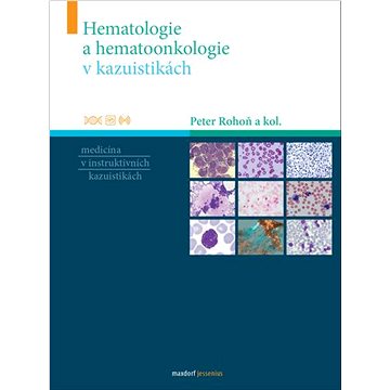 Hematologie a hematoonkologie v kazuistikách: Medicína v instruktivních kazuistikách (978-80-7345-681-8)