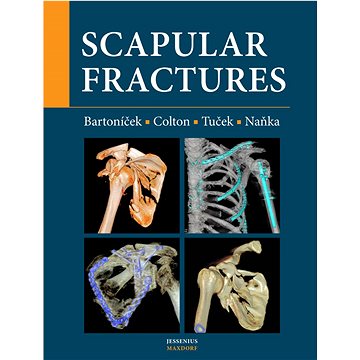 Scapular fractures (978-80-7345-731-0)