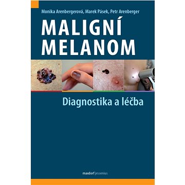 Maligní melanom: Diagnostika a léčba (978-80-7345-750-1)