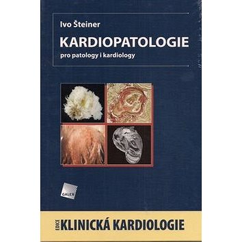 Kardiopatologie (978-80-7262-672-4)