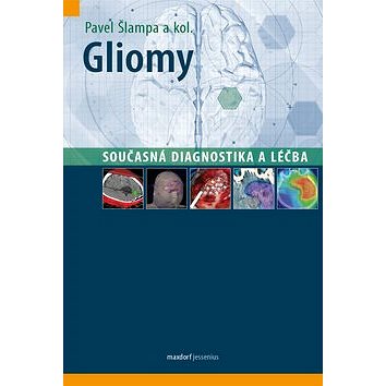 Gliomy - současná diagnostika a léčba (978-80-7345-321-3)