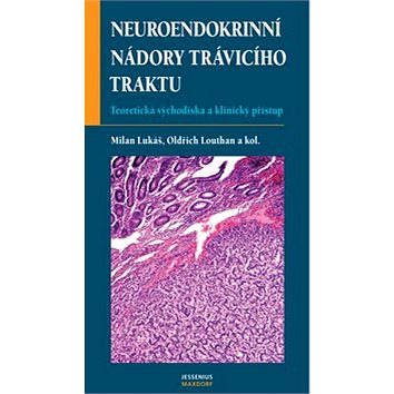 Neuroendokrinní nádory trávicí (80-7345-081-X)