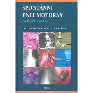 Spontánní pneumotorax: Etiopatogeneze, diagnostika, léčba (80-7345-126-3)