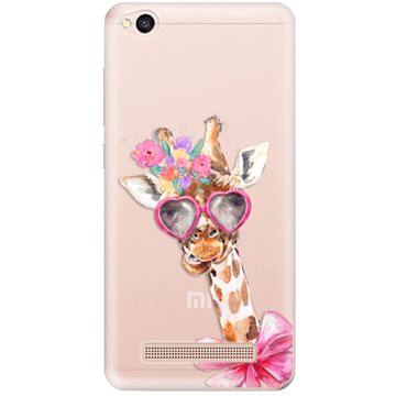 iSaprio Lady Giraffe pro Xiaomi Redmi 4A (ladgir-TPU2-Rmi4A)