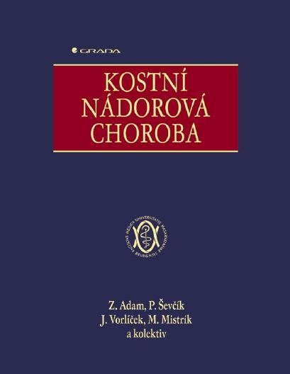 Kostní nádorová choroba