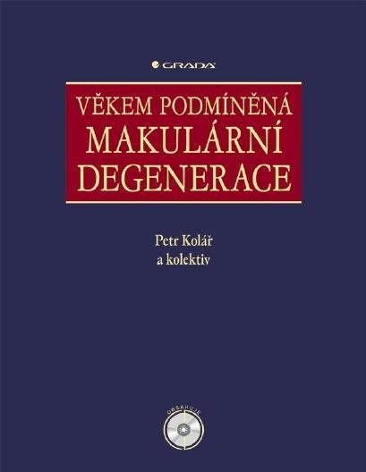 Věkem podmíněná makulární degenerace