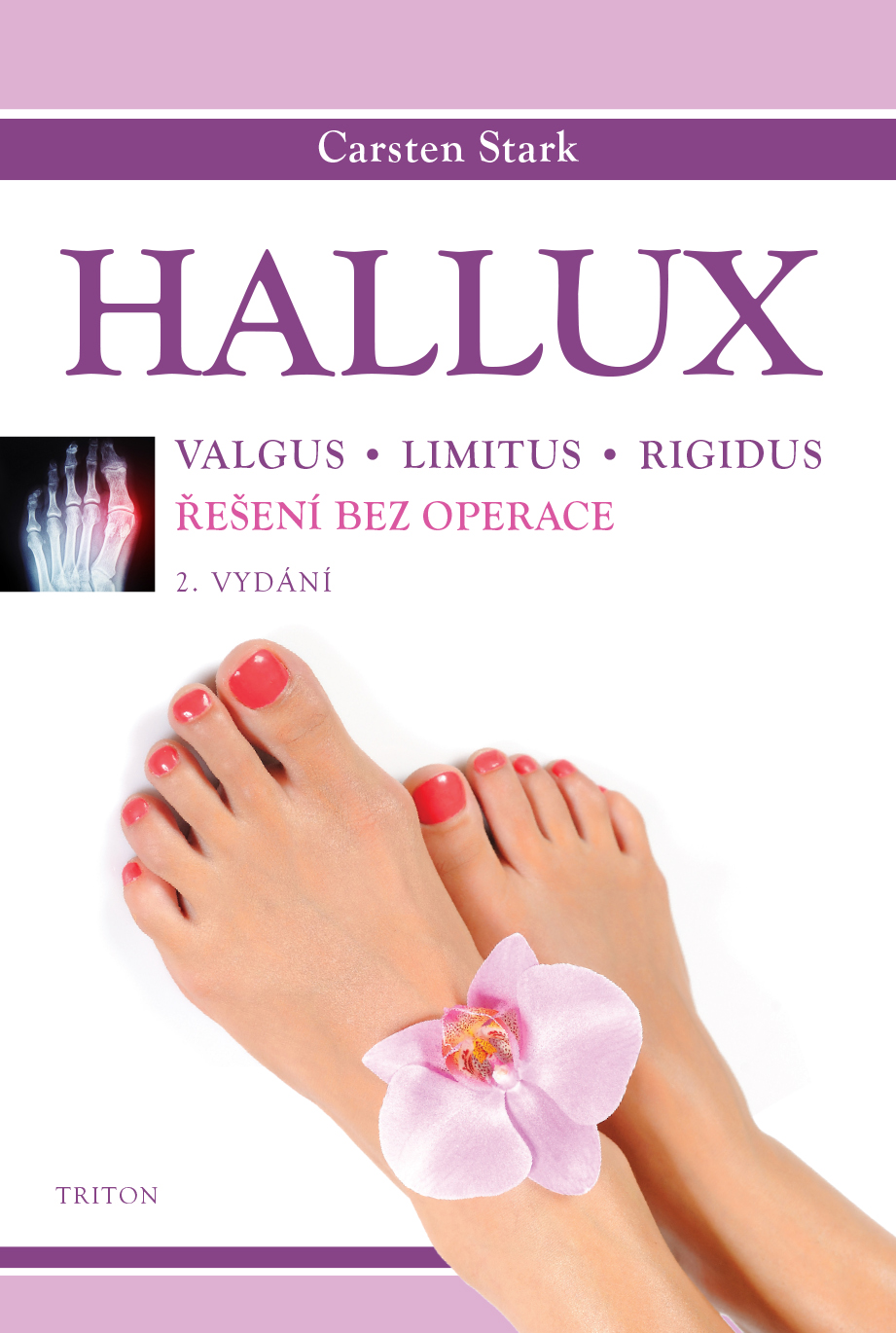Hallux