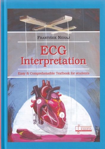 ECG Interpretation: Easy and Comprehensible Textbook for students
