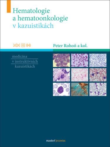 Hematologie a hematoonkologie v kazuistikách: Medicína v instruktivních kazuistikách