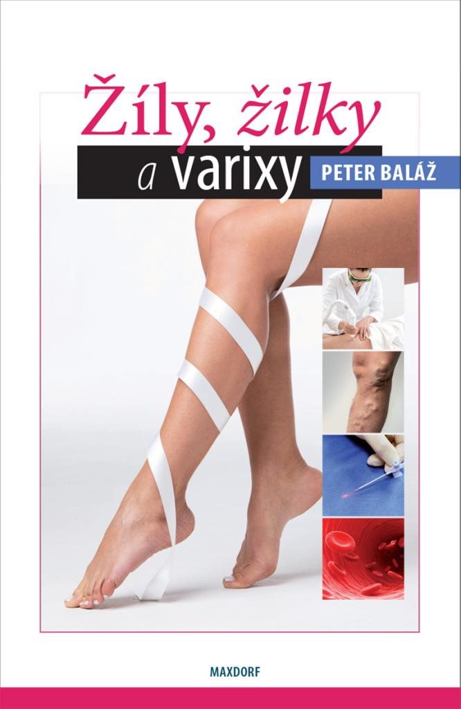Žíly, žilky, varixy