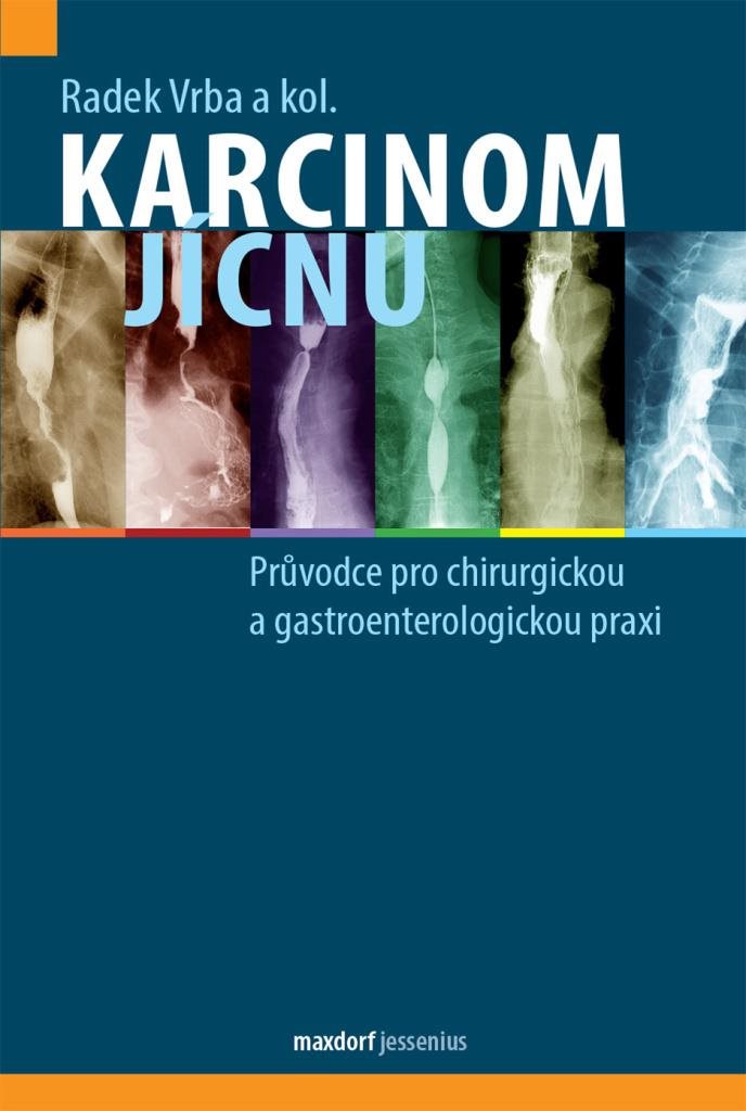 Karcinom jícnu: Průvodce pro chirurgickou a gastroenterologickou praxi