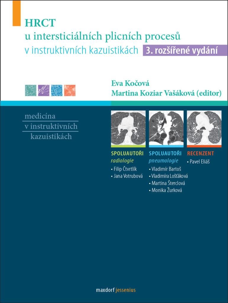 HRCT u intersticiálních plicních procesů v instruktivních kazuistikách: 3. rozšířené vydání