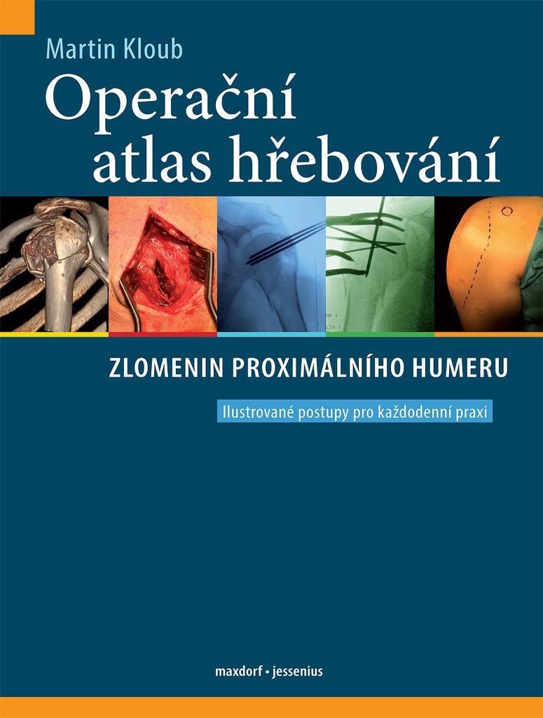 Operační atlas hřebování zlomenin proximálního humeru: Ilustrované postupy pro každodenní praxi