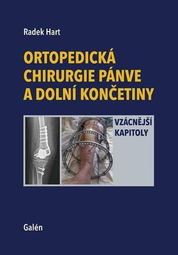 Ortopedická chirurgie pánve a dolní končetiny: Vzácnější kapitoly