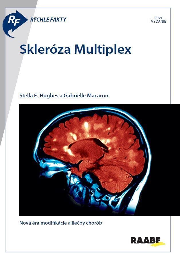 Skleróza Multiplex: Nová éra modifikácie a liečby chorôb