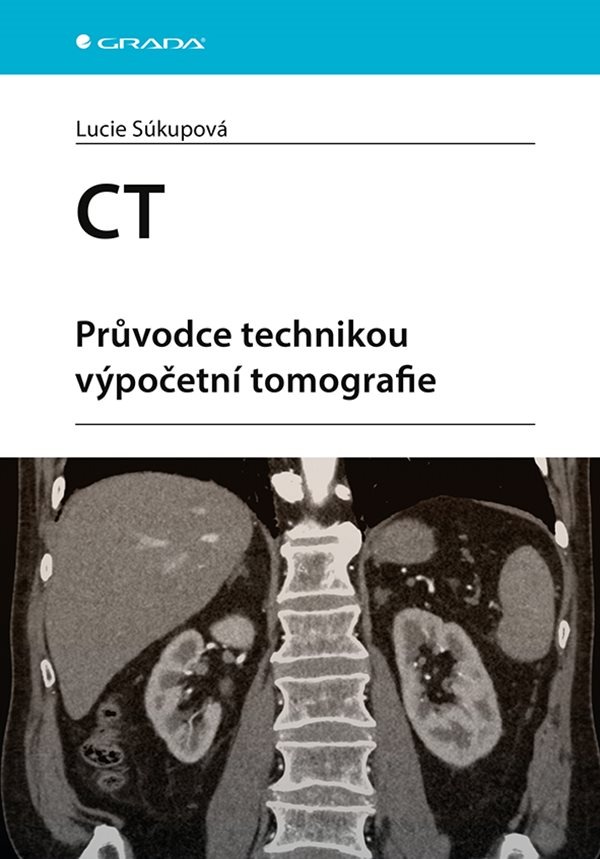 CT: Průvodce technikou výpočetní tomografie