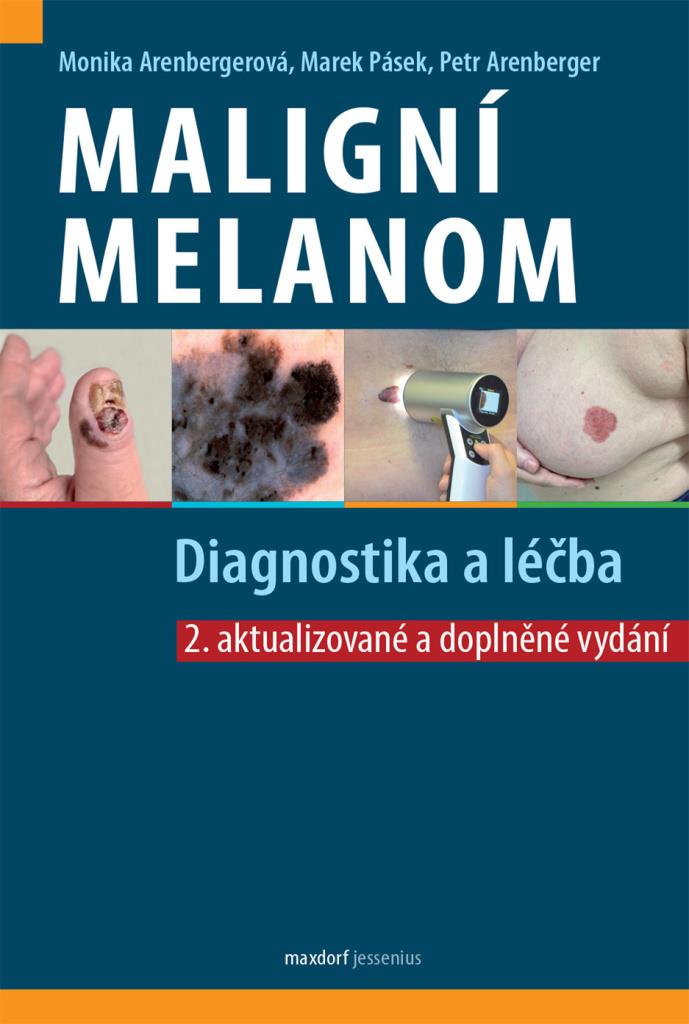 Maligní melanom: Diagnostika a léčba
