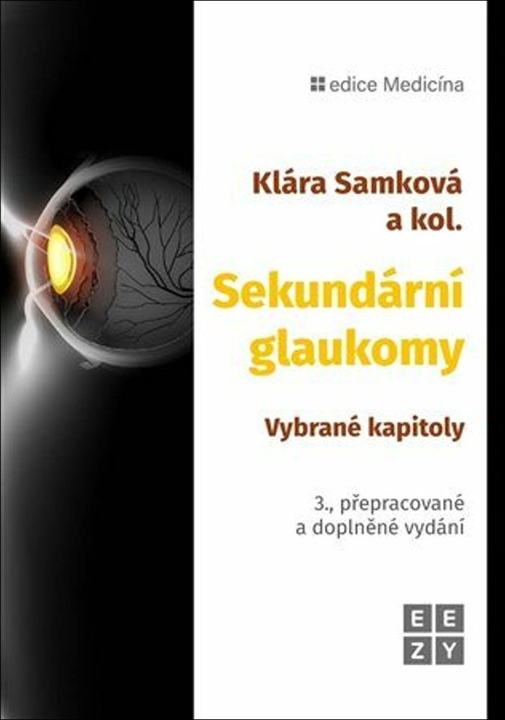 Sekundární glaukomy: Vybrané kapitoly