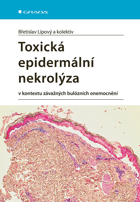 Toxická epidermální nekrolýza: v kontextu závažných bulózních onemocnění
