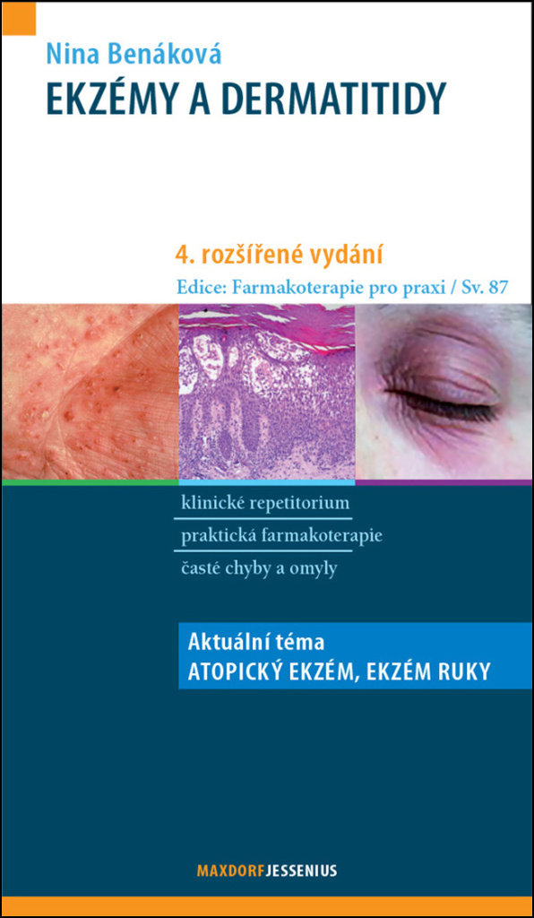 Ekzémy a dermatitidy: Aktuální téma: Chronický ekzém ruky, Atopický ekzém