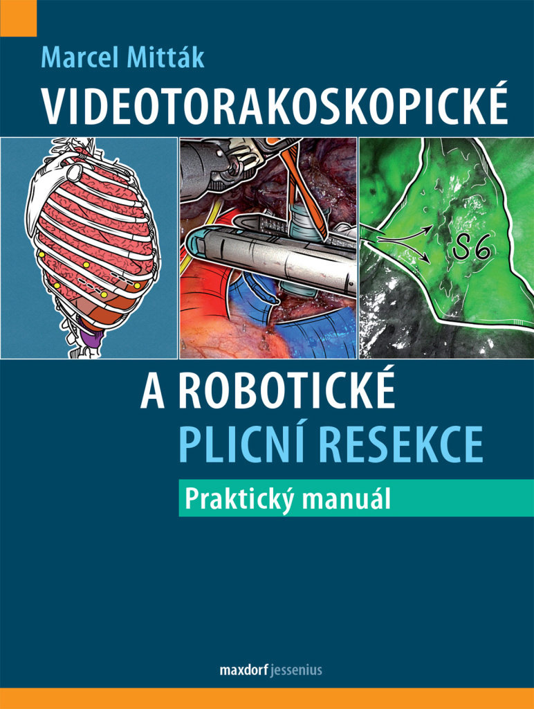 Videotorakoskopické a robotické plicní resekce: Praktický manuál