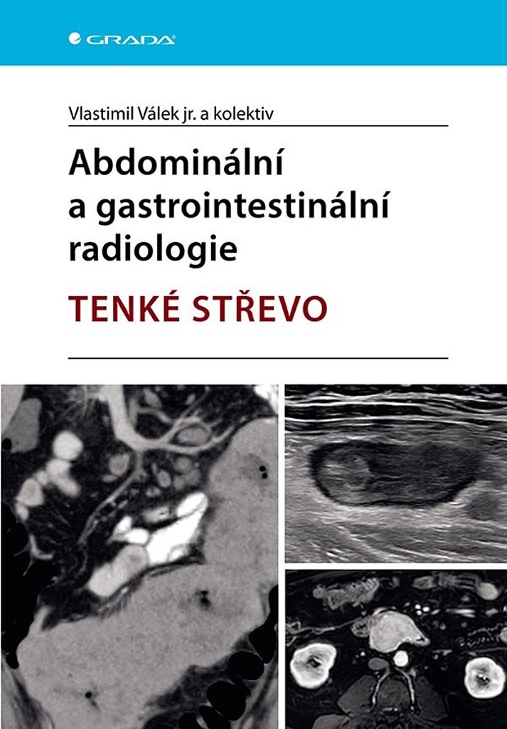 Abdominální a gastrointestinální radiolologie: Tenké střevo