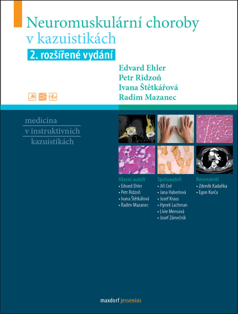 Neuromuskulární choroby v kazuistikách