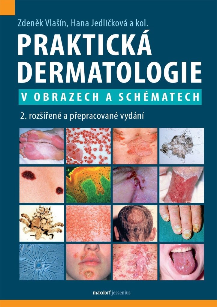 Praktická dermatologie v obrazech a schématech