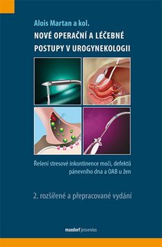 Nové operační a léčebné postupy v urogynekologii: Řešení stresové inkontinence moči,defektů pánevníh