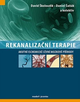 Rekanalizační terapie: Akutní ischemické cévní mozkové příhody