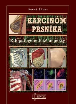 Karcinóm prsníka: Etiopatogenetické aspekty