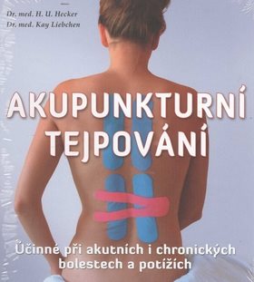 Akupunkturní tejpování: Účinné při akutních i chronických bolestech a potížích