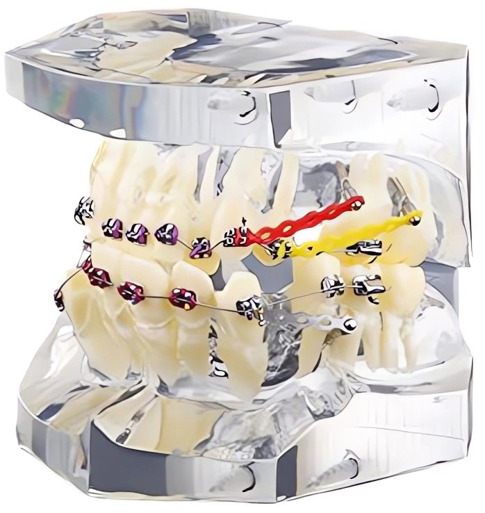 Ortodontický model zubů Verk 27403